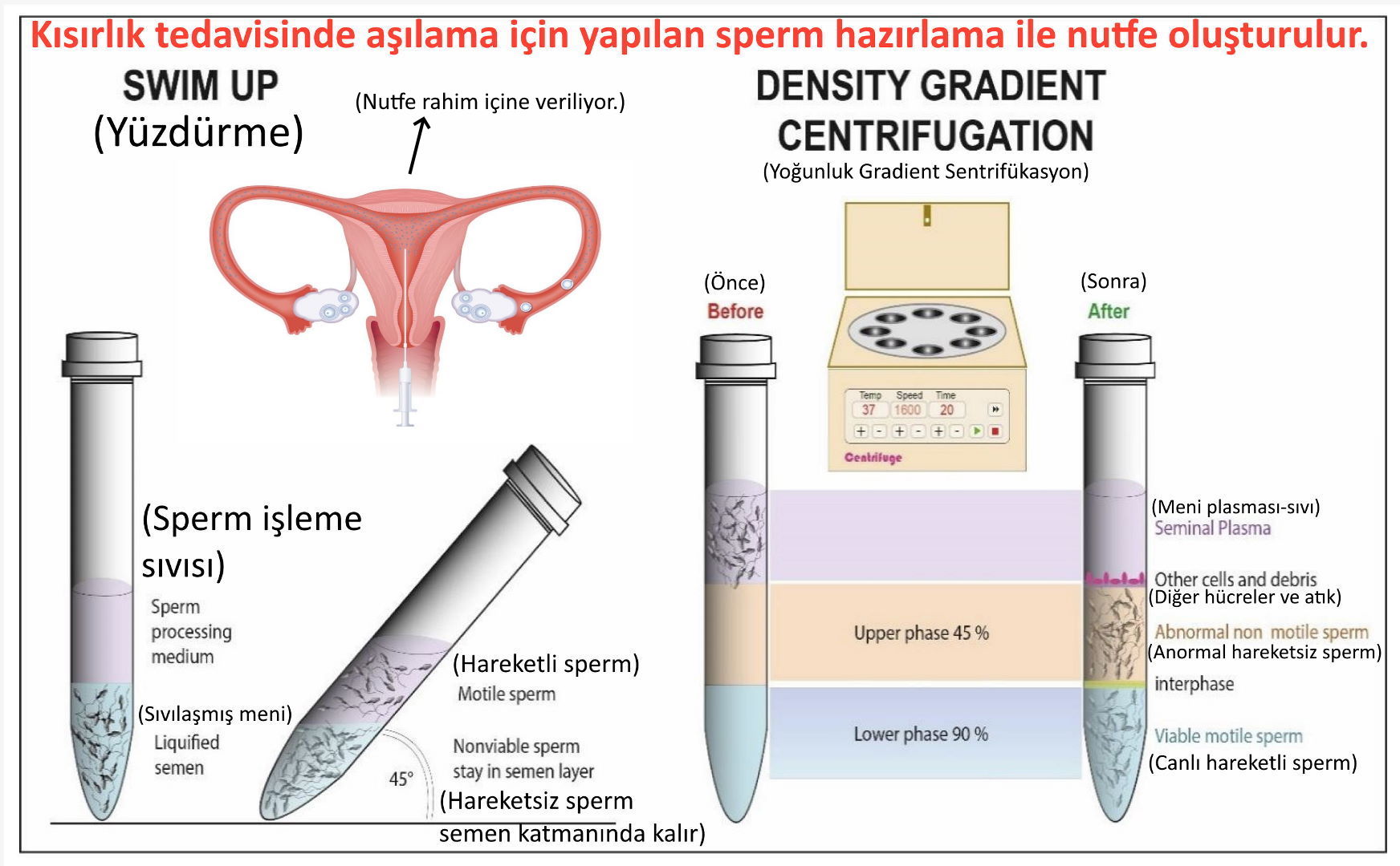 IUI asilama hazirlama nutfe