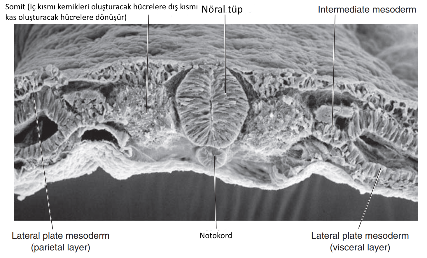 somite elekron mikroskopisi noral tup notokord