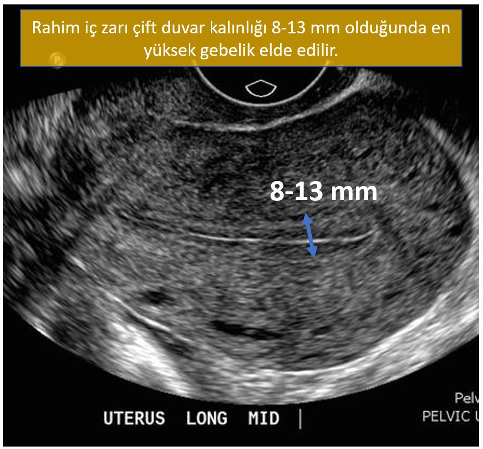 rahim ic tabakasi 8 13 mm en iyi gebelik usg tup bebek